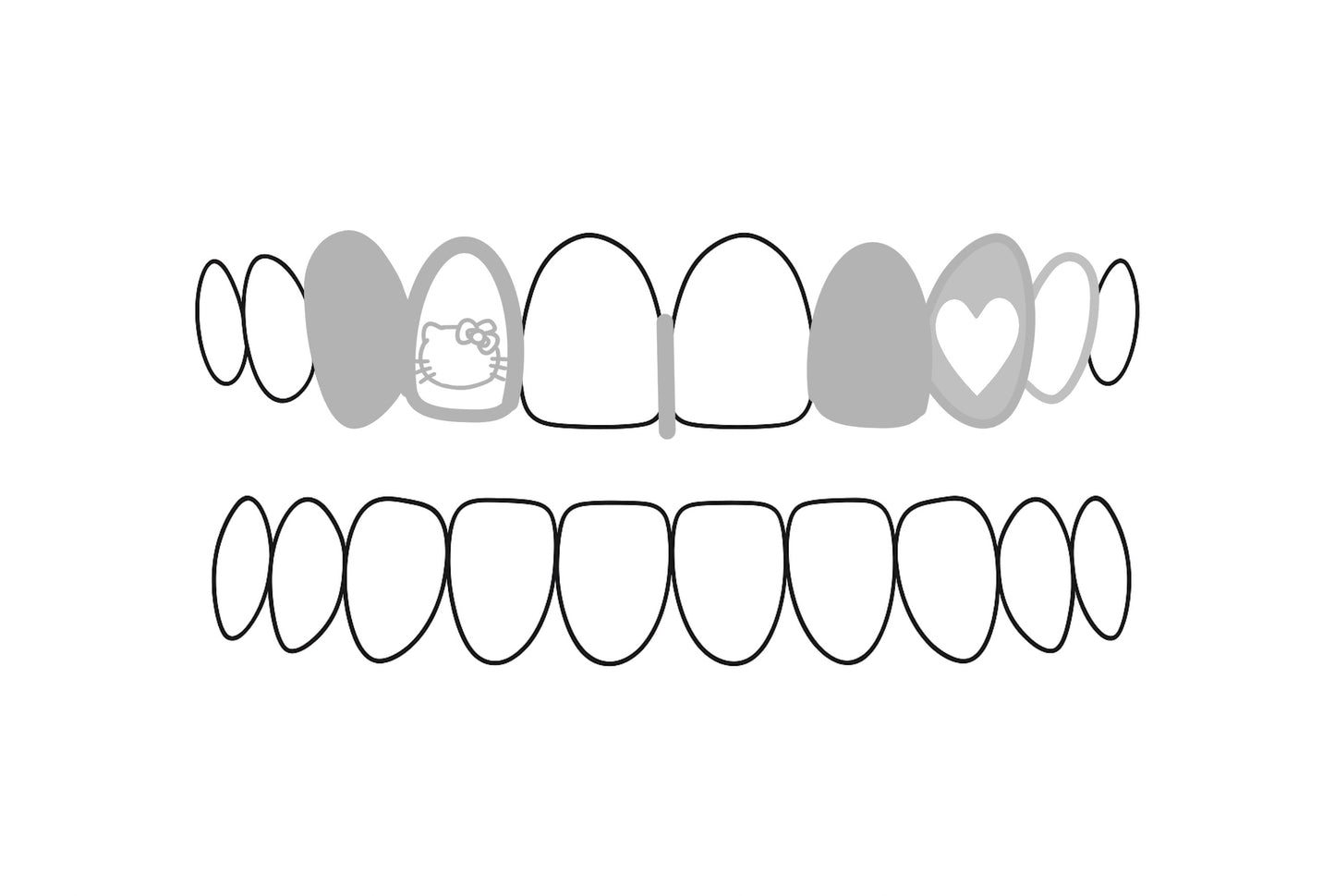 consultation grillz