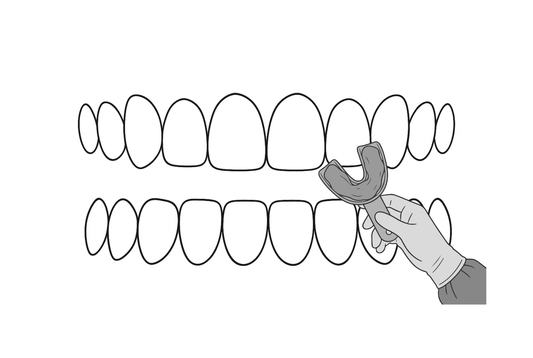 grillz consultatie