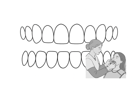grillz ophalen of reiningen