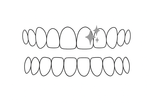 american teeth whitening