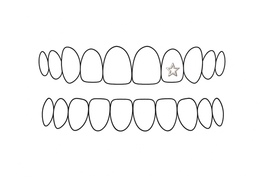 gouden tooth gems