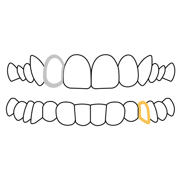 consultation grillz