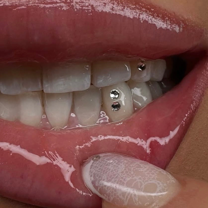 swarovski tandkristallen 