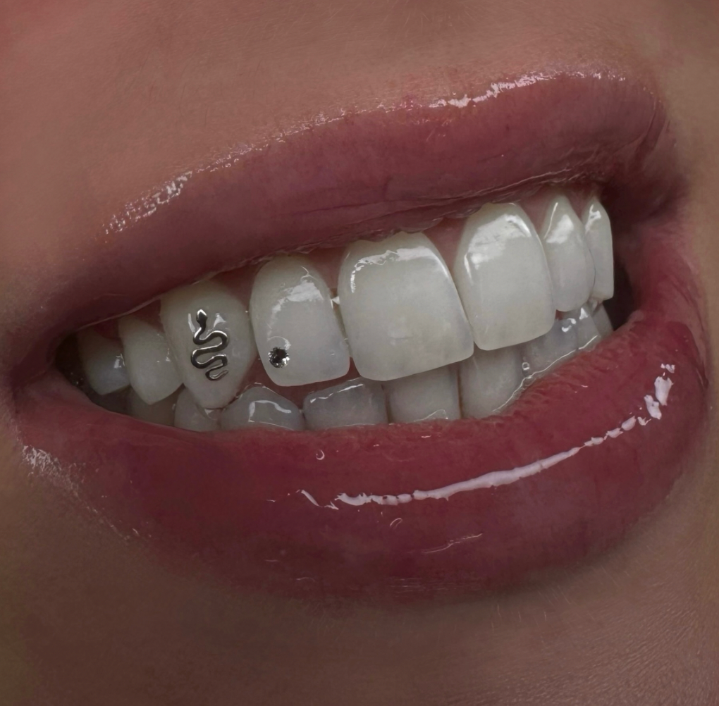 gouden tooth gems