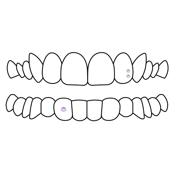 retouche sous garantie