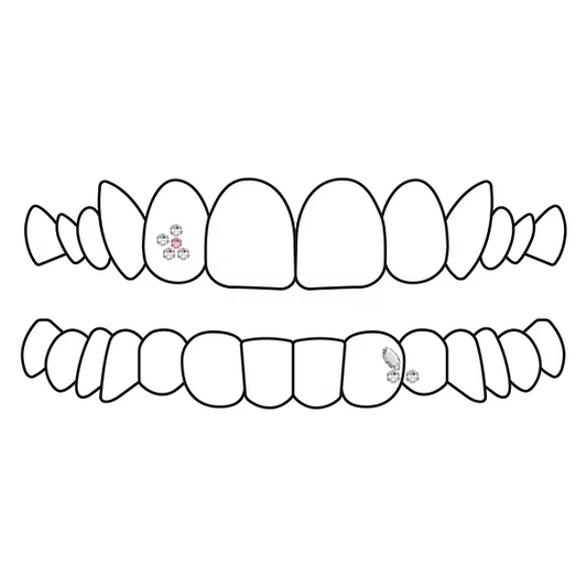 retouche hors garantie